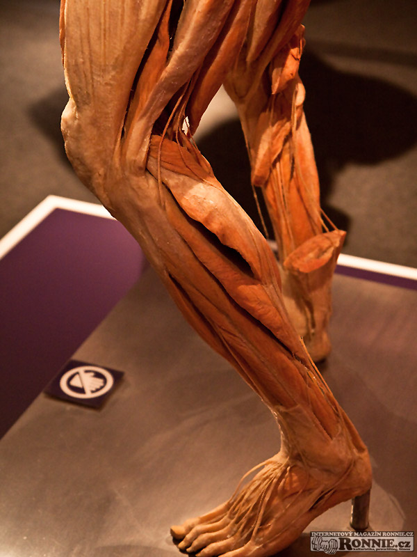 The Human Body Exhibition